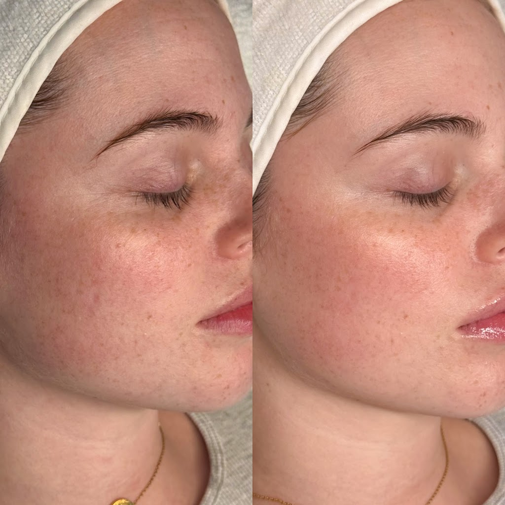 Phoenix Aesthetics Clinic | 30 Elizabeth Bay Dr, Lake Munmorah NSW 2259, Australia | Phone: 0448 784 066