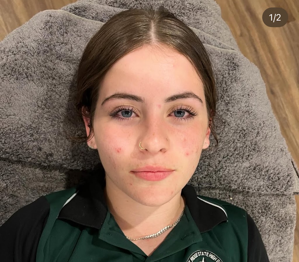 Rae of beauty electrolysis clinic | 78 Boomi Ave, South Maclean QLD 4280, Australia | Phone: 0493 367 666 Rae of beauty electrolysis clinic | 78 Boomi Ave, South Maclean QLD 4280, Australia | Phone: 0493 367 666