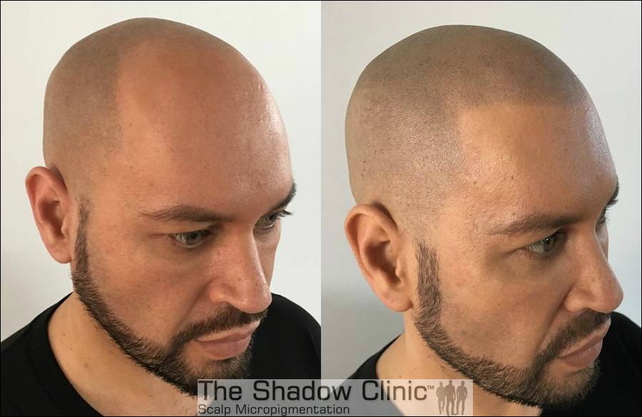 The Shadow Clinic Canberra | hair care | 1C/39 Grimwade St, Mitchell ACT 2911, Australia | 0468364200 OR +61 468 364 200
