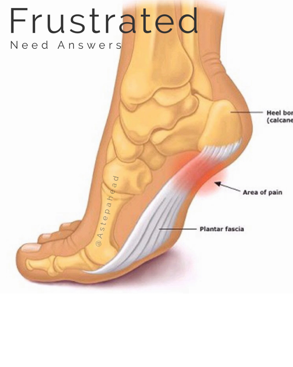 A Step Ahead Foot + Ankle Care | hospital | 24 Phillip St, St Marys NSW 2760, Australia | 0296732987 OR +61 2 9673 2987