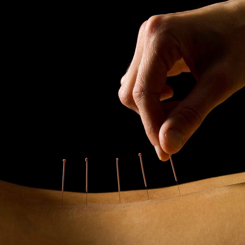 Doctor Li Wong Acupuncture | 98 Harp Rd, Kew VIC 3101, Australia | Phone: (03) 9891 3628