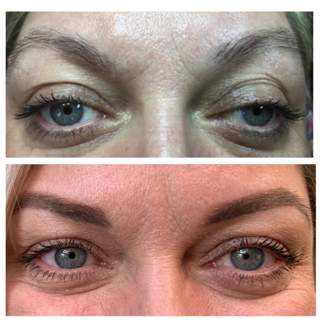 Brow Guru Brow Tattoo Threading Healing | beauty salon | 51 Crompton Dr, Wattle Park SA 5066, Australia | 0401278528 OR +61 401 278 528