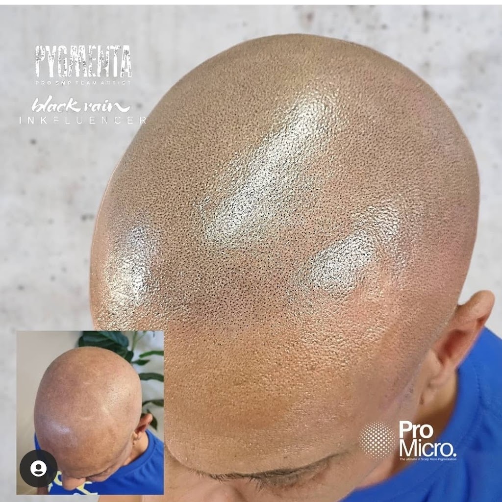 Pro Micro - Scalp Micropigmentation SMP | 23/58 Riverwalk Ave, Robina QLD 4226, Australia | Phone: 0437 778 852