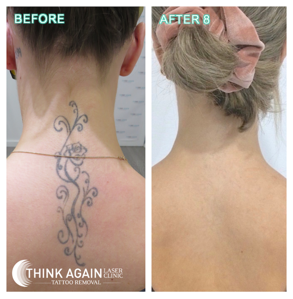 Think Again Laser Clinic |  | 2/188-190 Victoria Rd, Rozelle NSW 2039, Australia | 1300166465 OR +61 1300 166 465