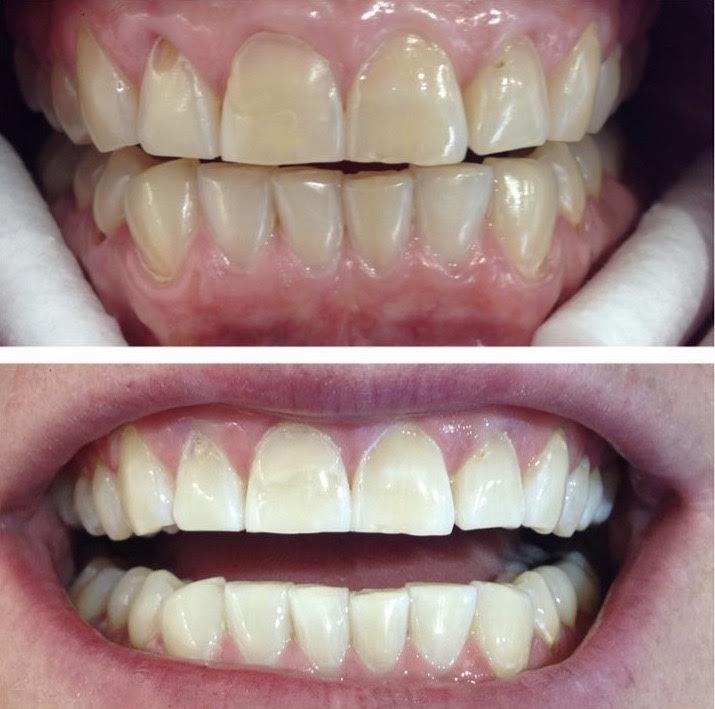 Smile Labs Albury | dentist | 7/525 David St, Albury NSW 2640, Australia | 0260415701 OR +61 2 6041 5701