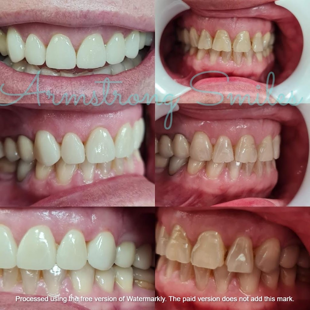 Armstrong Smiles | T01/500 - 540 Torquay Rd, Armstrong Creek VIC 3217, Australia | Phone: (03) 5215 1333