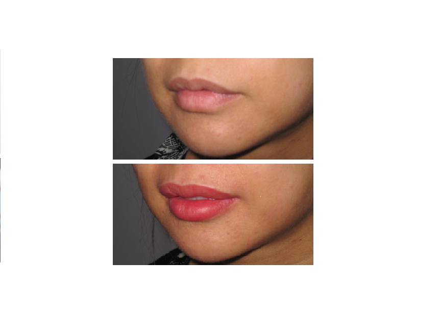 Cosmetic Tattoo from 129 AUD Best Eyebrows Tattooing Lip Eyeline | store | 588 Glen Huntly Rd, Elsternwick VIC 3185, Australia | 0406200668 OR +61 406 200 668