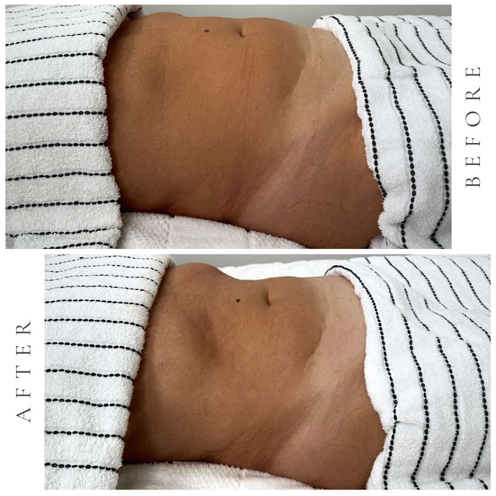 Curve - Massage and Pilates | 1 Hornet Pl, Burleigh Heads QLD 4220, Australia | Phone: 0438 706 985