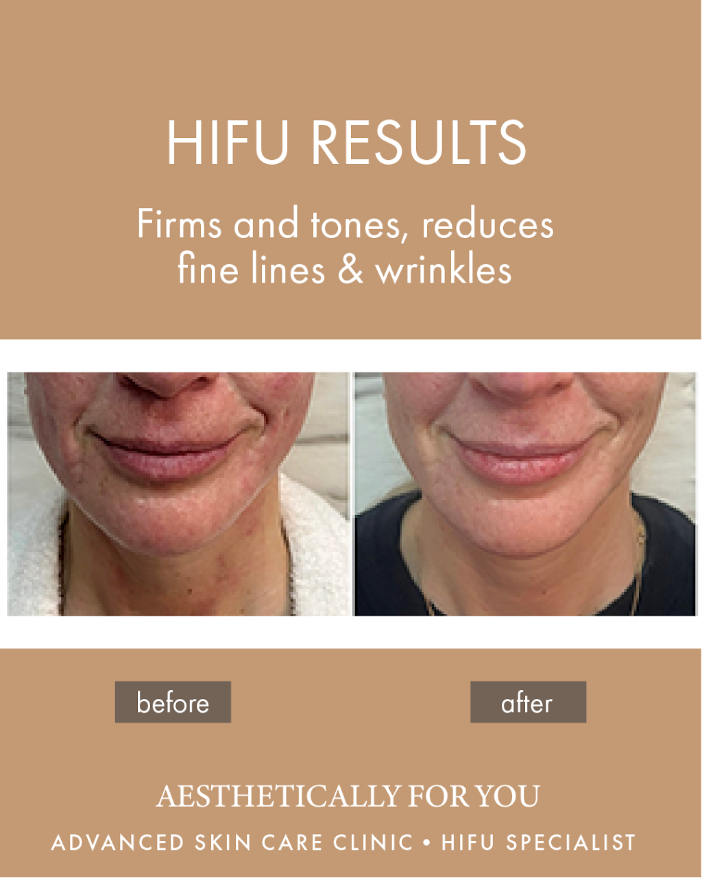 Aesthetically For You | 44 Valias St, North Warrandyte VIC 3113, Australia | Phone: 0422 915 093