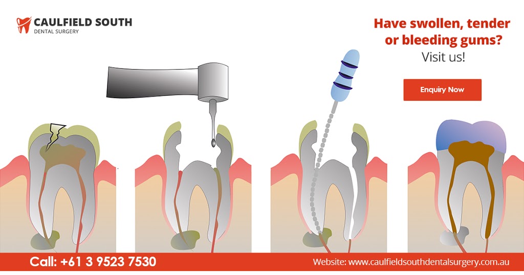 Caulfield South Dental Surgery ? | dentist | 858 Glen Huntly Rd, Caulfield South VIC 3162, Australia | 0395237530 OR +61 3 9523 7530