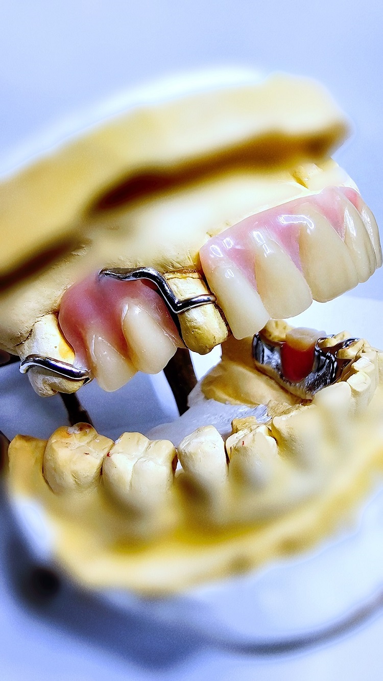 Hill End Dental Laboratory | 8 Majors Ave, Colebee NSW 2761, Australia | Phone: 0410 112 083