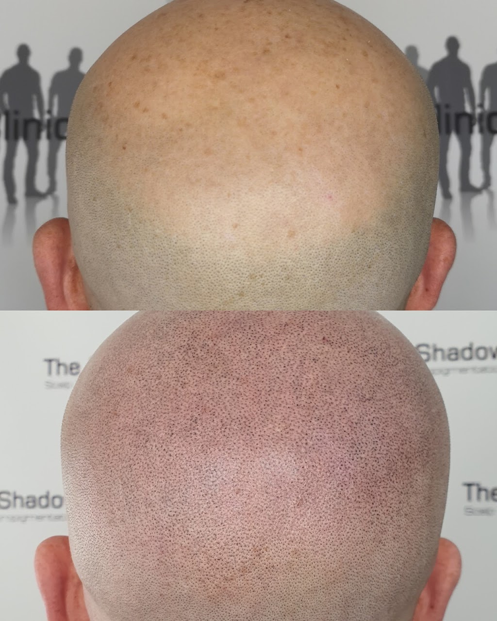 The Shadow Clinic Canberra | 1C/39 Grimwade St, Mitchell ACT 2911, Australia | Phone: 0468 364 200
