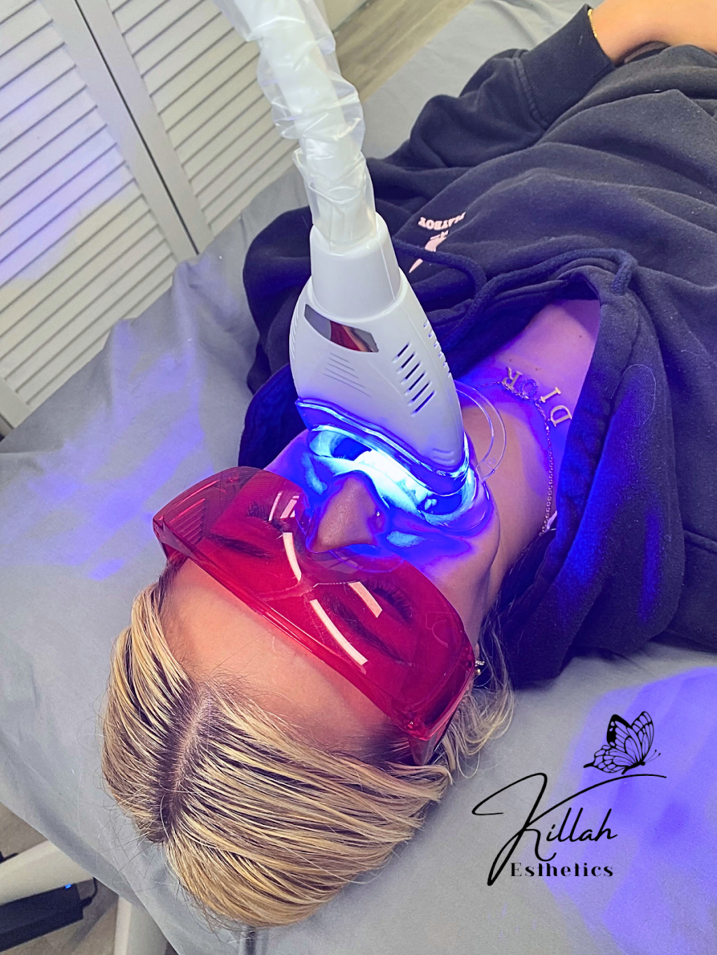 KillahEsthetics | 34 Wandewoi Ave, San Remo NSW 2262, Australia | Phone: 0422 214 280