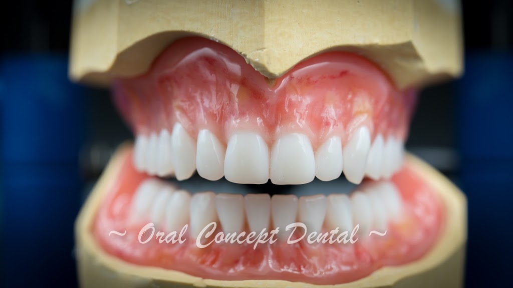Oral Concept Dental Laboratory | 25 Whiteside St, Cloverdale WA 6105, Australia | Phone: (08) 9277 4202
