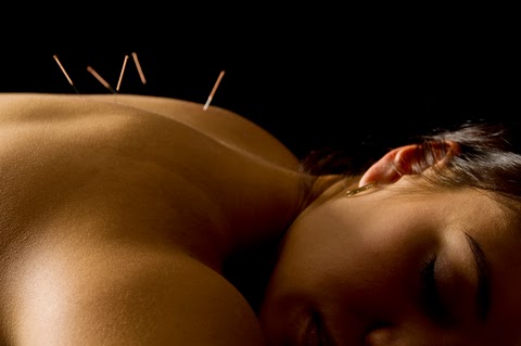 Melbourne Acupuncture | health | 206/122 Toorak Rd, South Yarra VIC 3141, Australia | 0398045775 OR +61 3 9804 5775