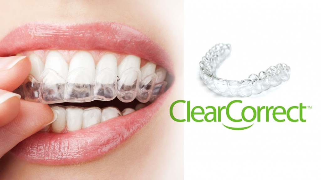 Confident Smile Dental & Facial Clinic | 74 Bellarine Hwy, Newcomb VIC 3219, Australia | Phone: (03) 5242 8740