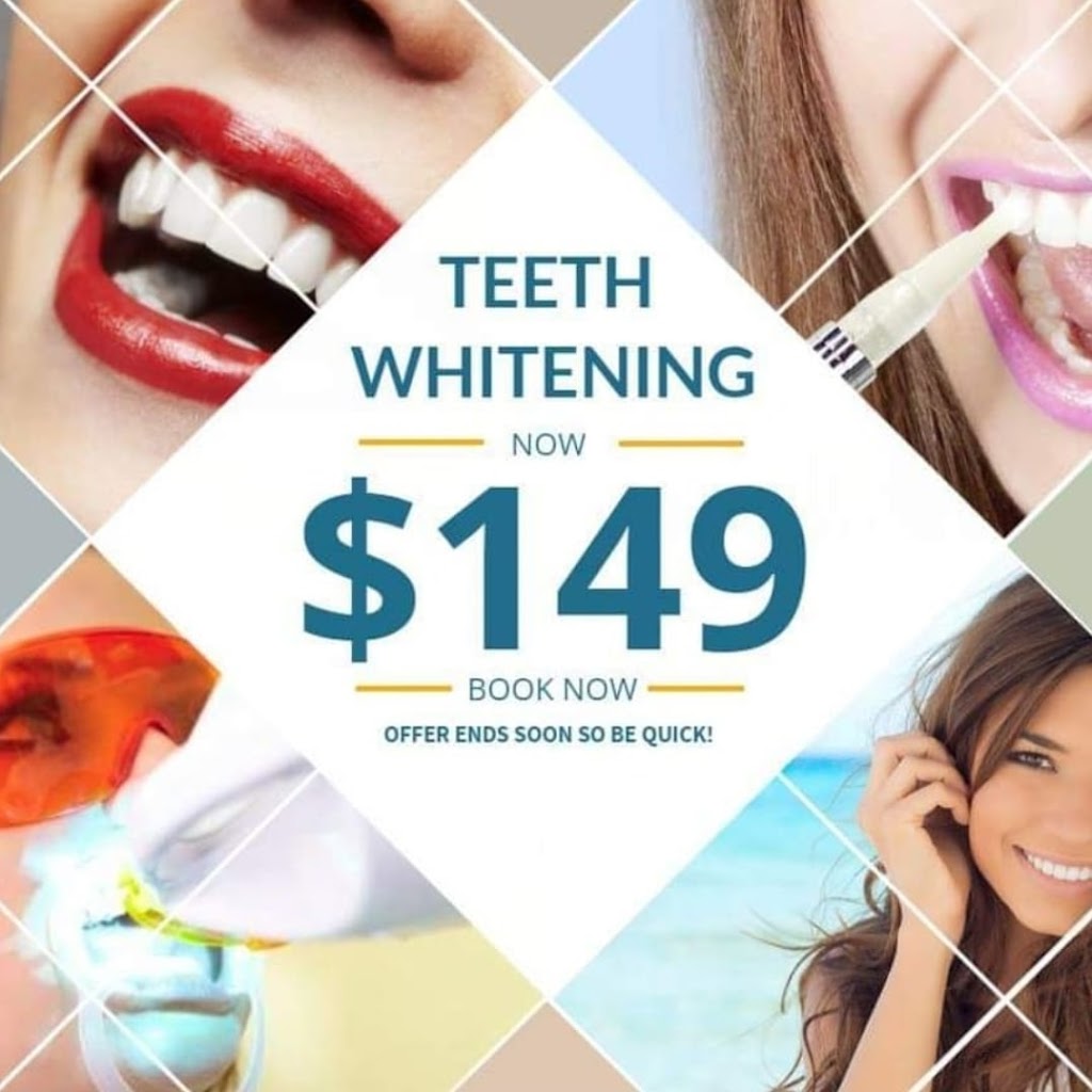 Exotic Touch teeth whitening | Centenary Court, Warner QLD 4500, Australia | Phone: 0499 380 644