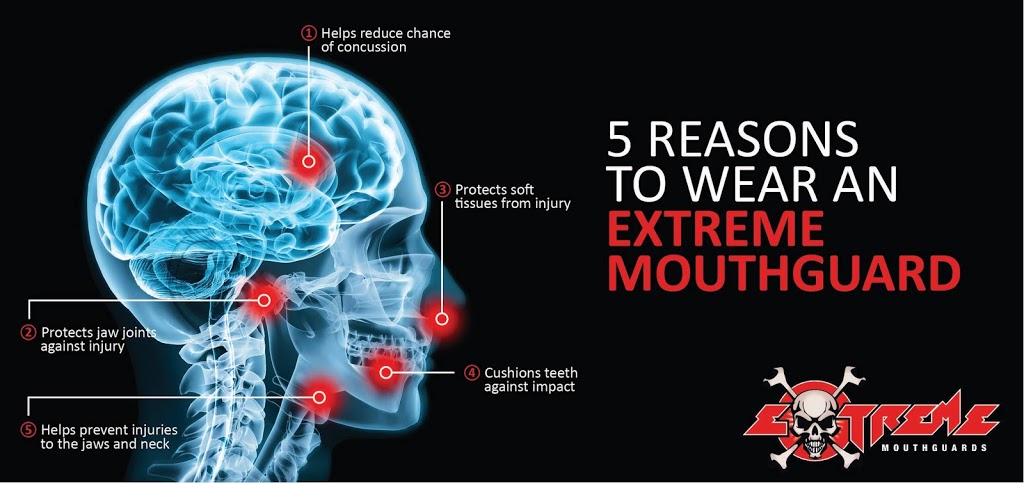 Extreme Mouthguards | health | b1/550 Canning Hwy, Attadale WA 6156, Australia | 0893177777 OR +61 8 9317 7777
