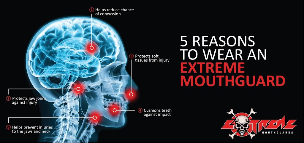 Extreme Mouthguards | b1/550 Canning Hwy, Attadale WA 6156, Australia | Phone: (08) 9317 7777