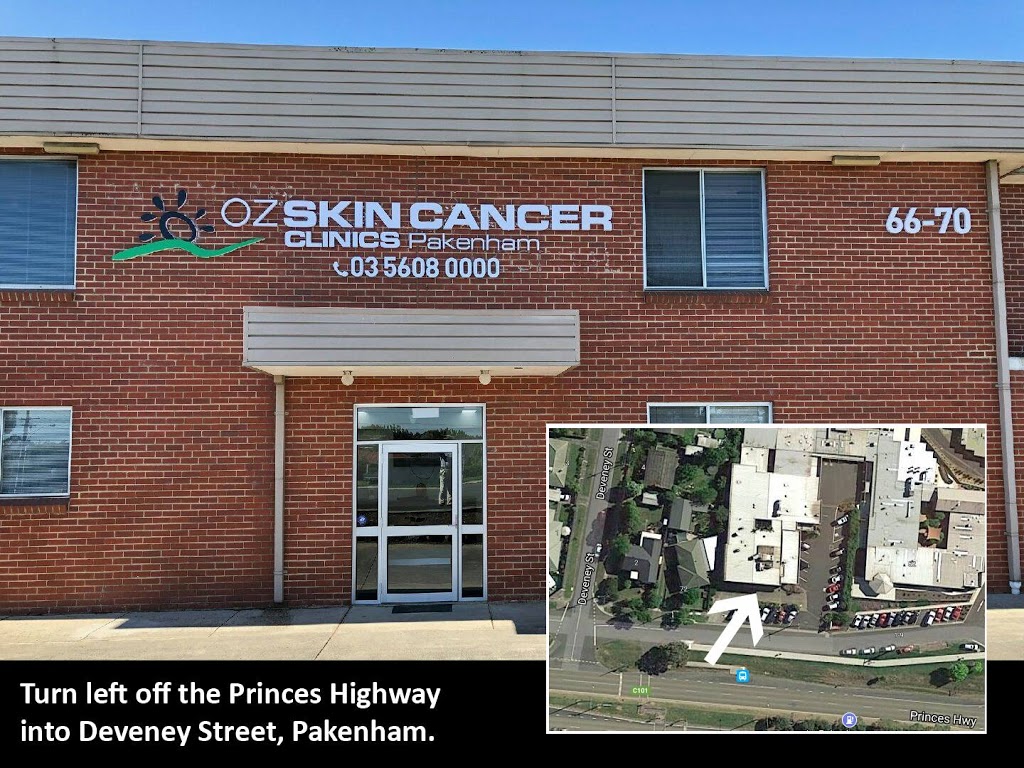 Oz Skin Cancer Clinics | 66-70 Princes Hwy, Pakenham VIC 3810, Australia | Phone: (03) 5608 0000