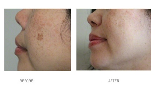 Aimei Beauty | 118 James St, Templestowe VIC 3108, Australia | Phone: 0424 878 530
