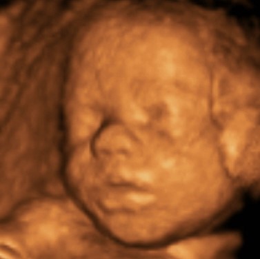 Peek A Boo 3D Ultrasound | health | 2/46 Bay Rd, Taren Point NSW 2229, Australia | 0411731059 OR +61 411 731 059
