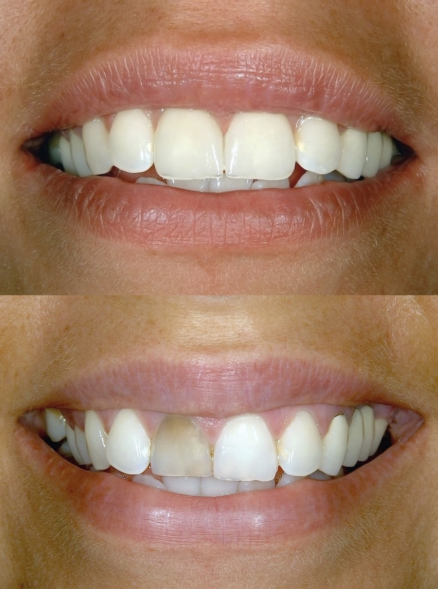Dr Jeremy Keating | dentist | 11 Kings Rd, Subiaco WA 6008, Australia | 0893881557 OR +61 8 9388 1557