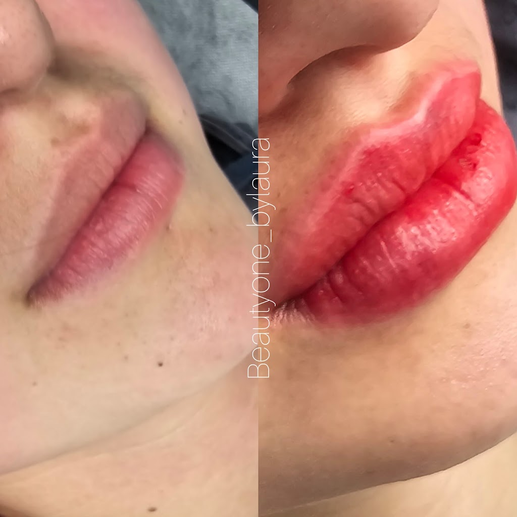 Beauty One | 20 Birdwood St, Denistone East NSW 2111, Australia | Phone: 0449 012 123