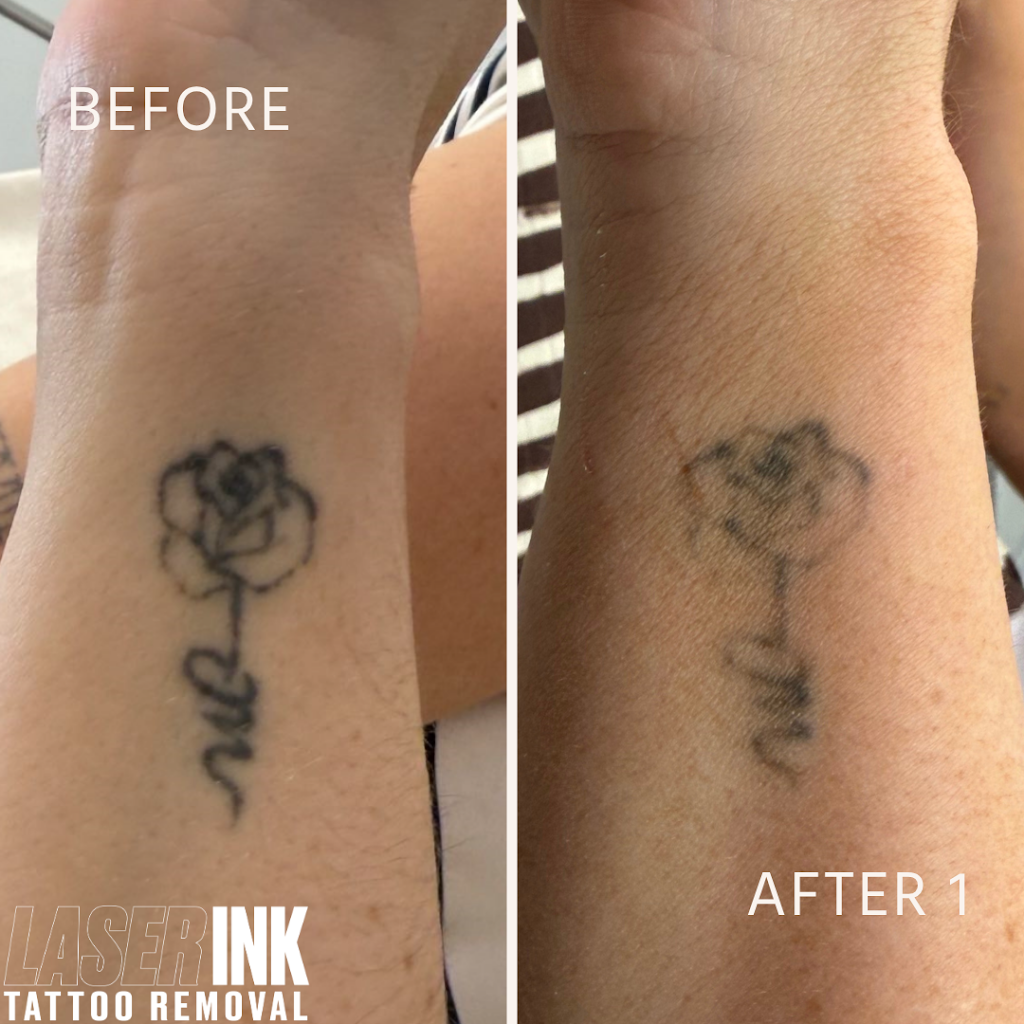 Laser Ink | 11/260 Captain Cook Dr, Kurnell NSW 2331, Australia | Phone: 0413 850 148