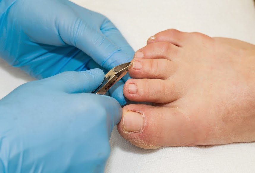 PRECISE PODIATRY | hospital | 45 Walkers Rd, Lara VIC 3212, Australia | 0352822999 OR +61 3 5282 2999