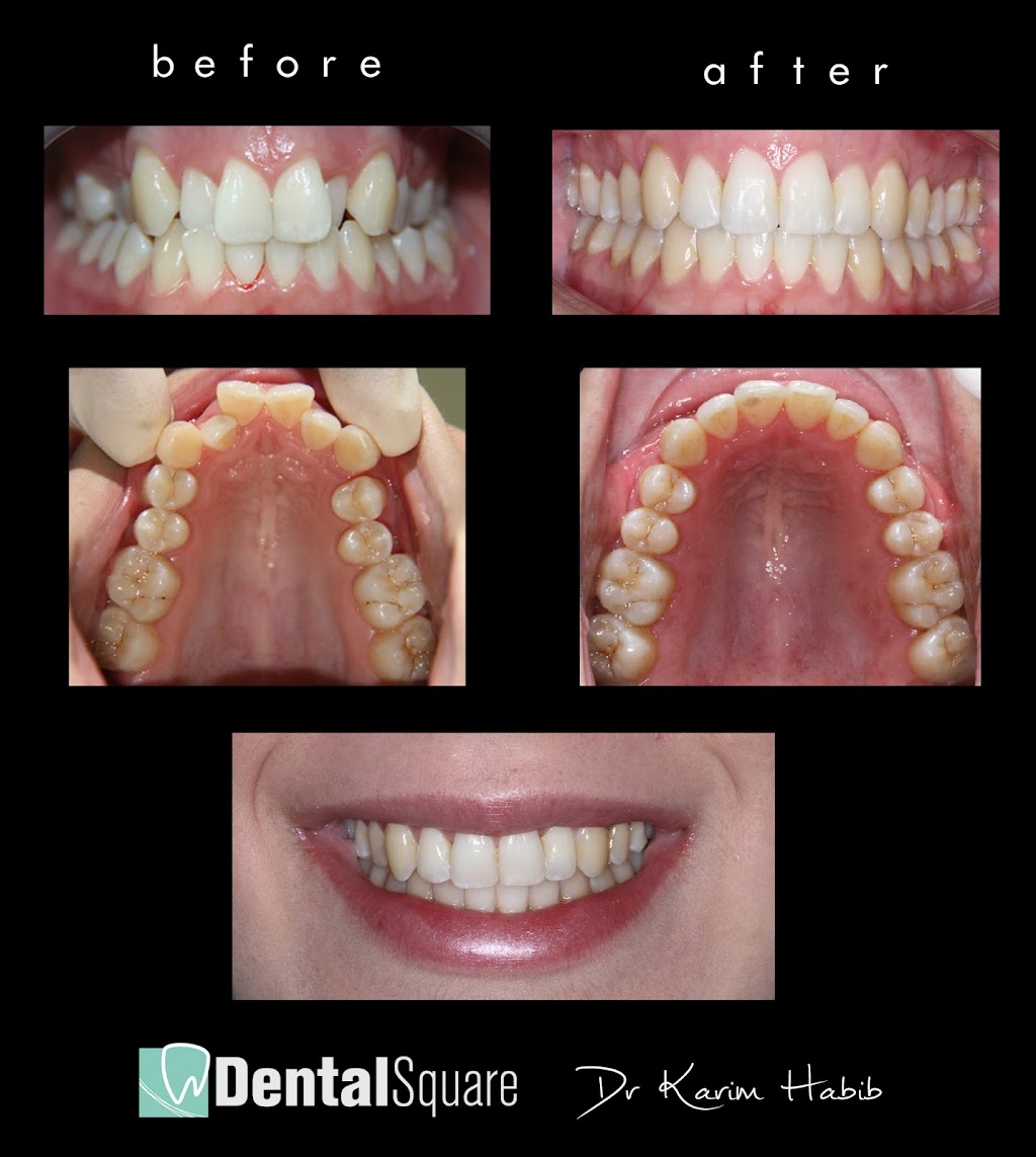 Dental Square | dentist | 5 Chatham Rd, West Ryde NSW 2114, Australia | 0280682109 OR +61 2 8068 2109