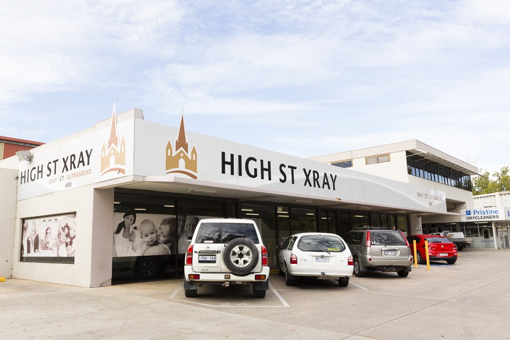 High St Xray | health | 149-151 High St, Bendigo VIC 3550, Australia | 0354419999 OR +61 3 5441 9999