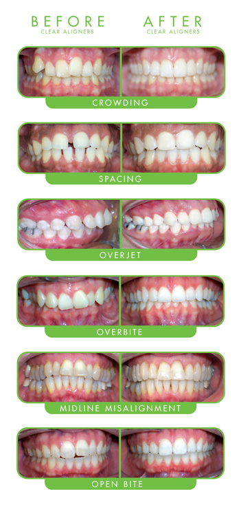 The Smile Workx - Dentist Noosa | dentist | 48 Mary St, Noosaville QLD 4566, Australia | 61753002133 OR +61 7 5474 3311