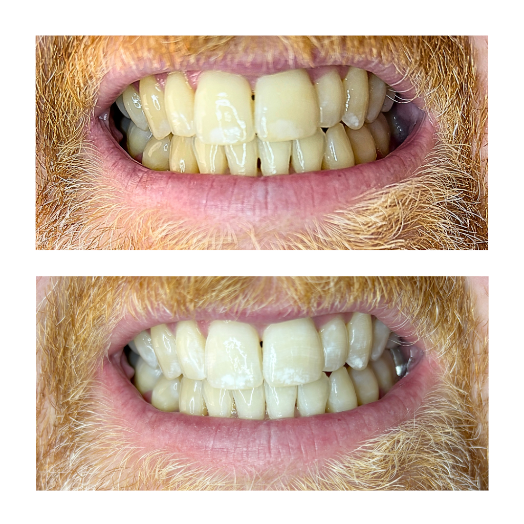 The Whitening Room | MacDougall Rd, Golden Gully VIC 3555, Australia | Phone: 0426 284 861