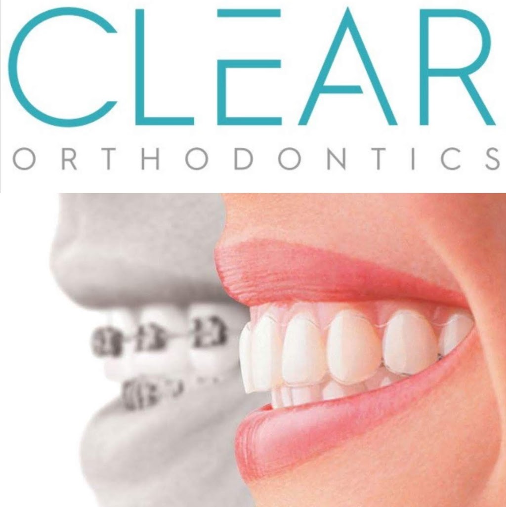 Clear Orthodontics | dentist | Shop 3/11-17 Pearcedale Parade, Broadmeadows VIC 3047, Australia | 0393095699 OR +61 3 9309 5699
