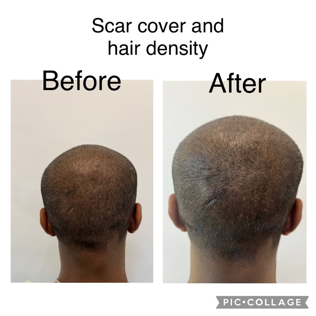 Scalp It SMP Hair Clinic | 11 - 13 Main St, Mount Annan NSW 2567, Australia | Phone: 0405 222 339