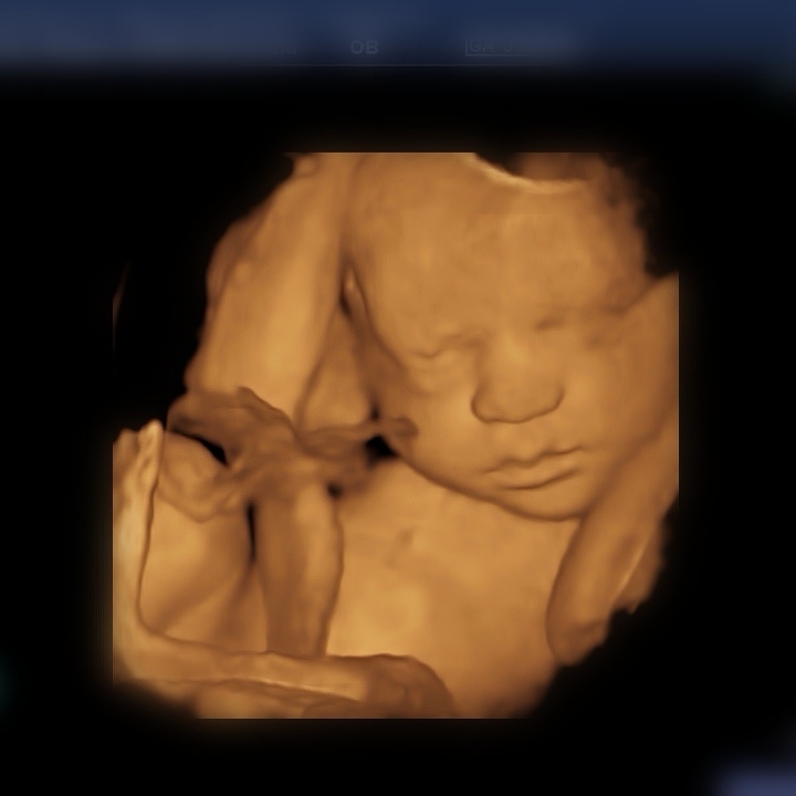 Baby Glimpse 3D/4D ultrasound | health | 2 Boronia Ave, Burwood NSW 2134, Australia | 0405068603 OR +61 405 068 603