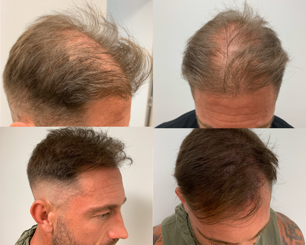 Scalp Revival | hair care | 395 Princes Hwy, Woonona NSW 2517, Australia | 0432286697 OR +61 432 286 697