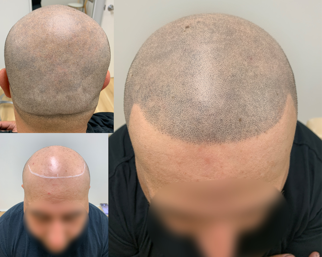 Scalp Revival | 395 Princes Hwy, Woonona NSW 2517, Australia | Phone: 0432 286 697