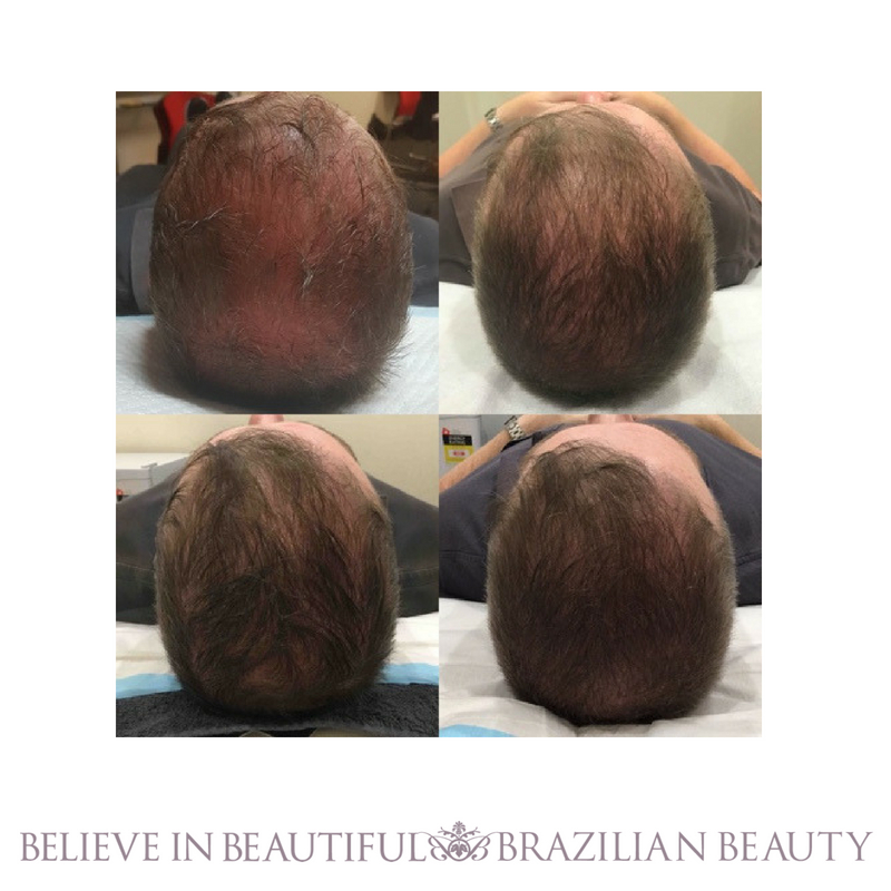 Brazilian Beauty Mango Hill | hair care | Mango Hill Marketplace 10, 1/21 Halpine Dr, Mango Hill QLD 4509, Australia | 0734823600 OR +61 7 3482 3600
