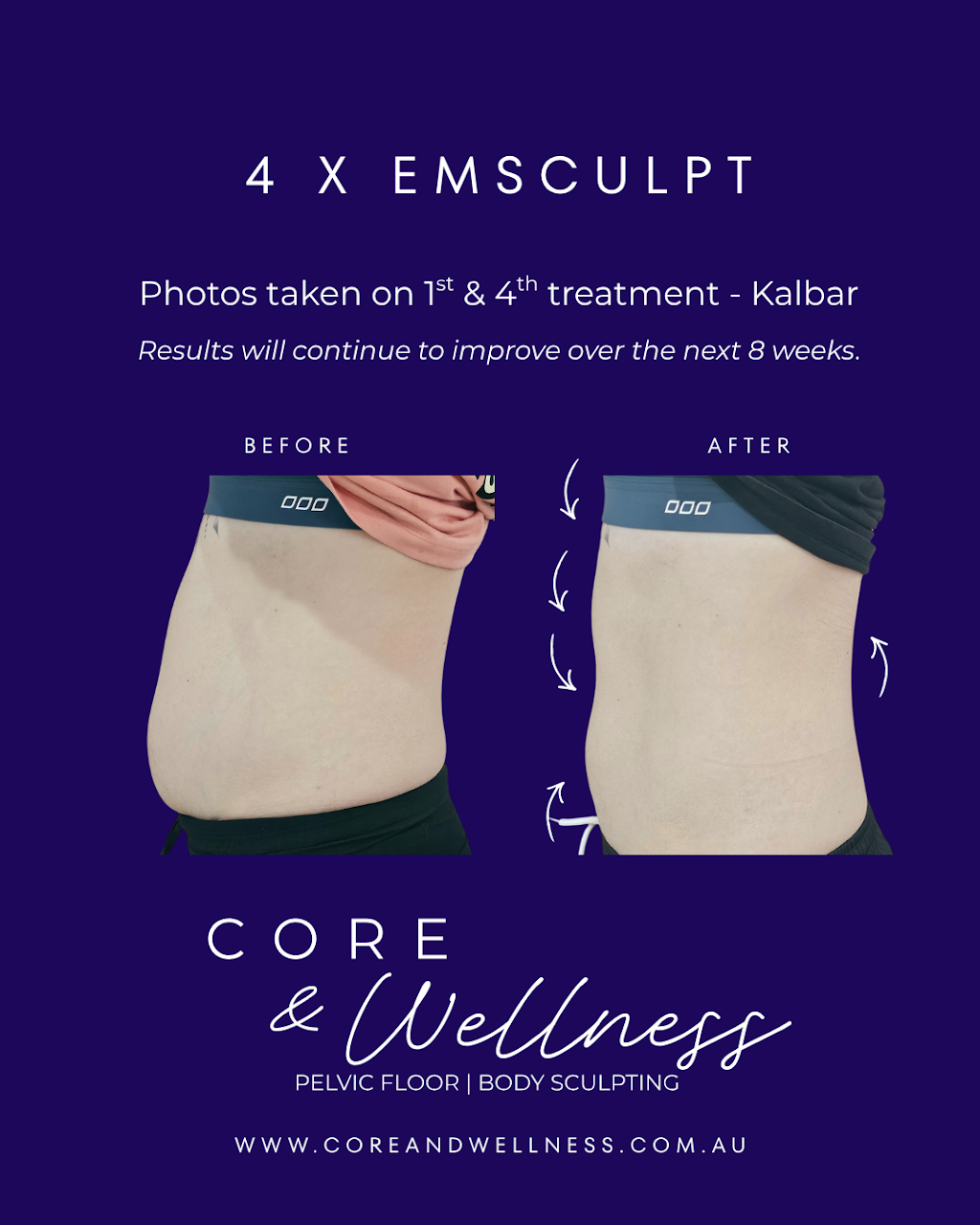 Core & Wellness | Unit 7/89 George St, Kalbar QLD 4305, Australia | Phone: 0430 130 133