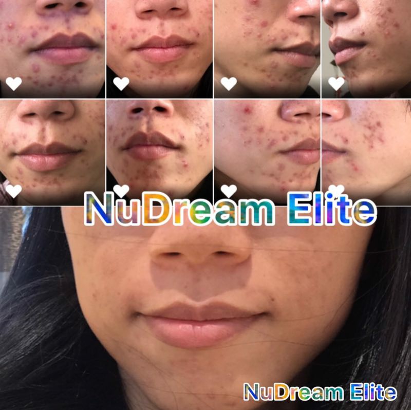 Nu Skin Melbourne & Beauty And Wellness | beauty salon | 6 Deauville Ct, Wantirna VIC 3152, Australia | 0422033226 OR +61 422 033 226
