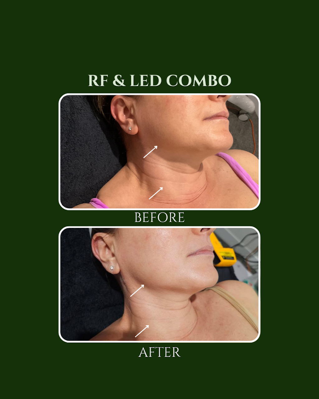 Bodiez By B | 5/141 Maudsland Rd, Oxenford QLD 4210, Australia | Phone: 0447 106 981