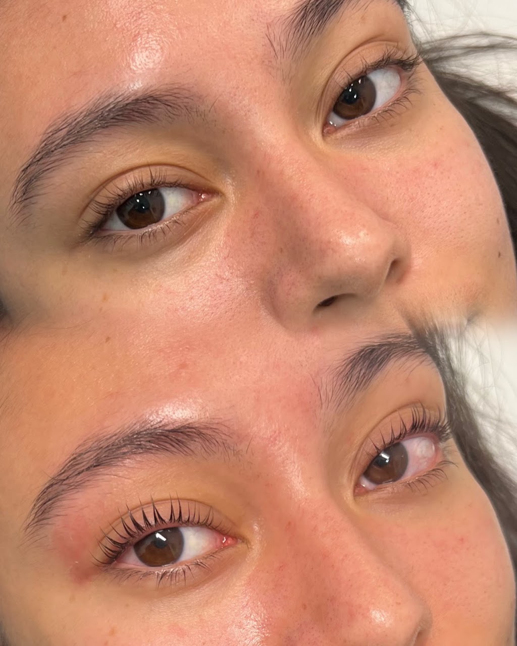 Laser By Zara | 1 Inverness Cct, Cecil Hills NSW 2171, Australia | Phone: 0420 770 846