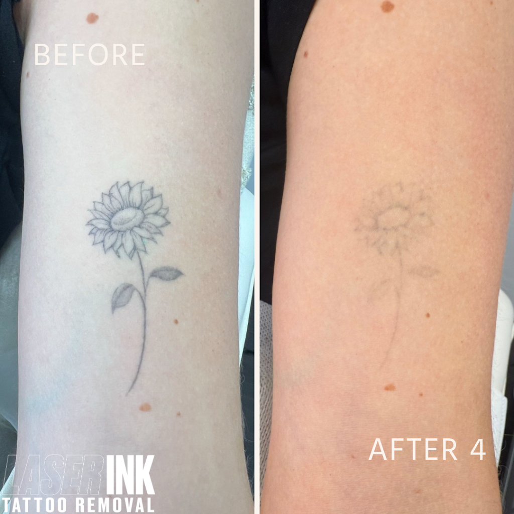 Laser Ink | 11/260 Captain Cook Dr, Kurnell NSW 2331, Australia | Phone: 0413 850 148