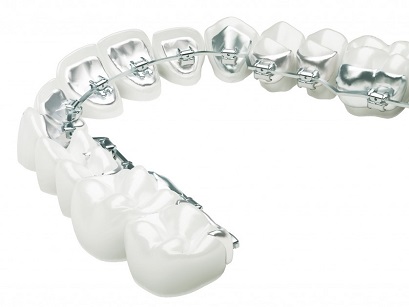 Inline Orthodontics | dentist | 12/2 Finucane Rd, Capalaba QLD 4157, Australia | 0734880002 OR +61 7 3488 0002