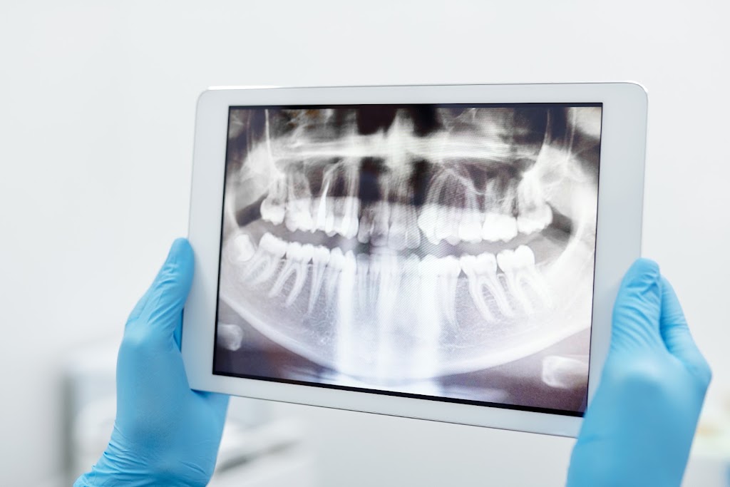 Parkwood Dentistry and Implants | Shop 4, 76/122 Napper Rd, Parkwood QLD 4214, Australia | Phone: (07) 5563 3727