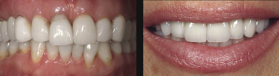 Five Dock Dentists | dentist | 1b/249 Great N Rd, Five Dock NSW 2046, Australia | 0280469981 OR +61 2 8046 9981