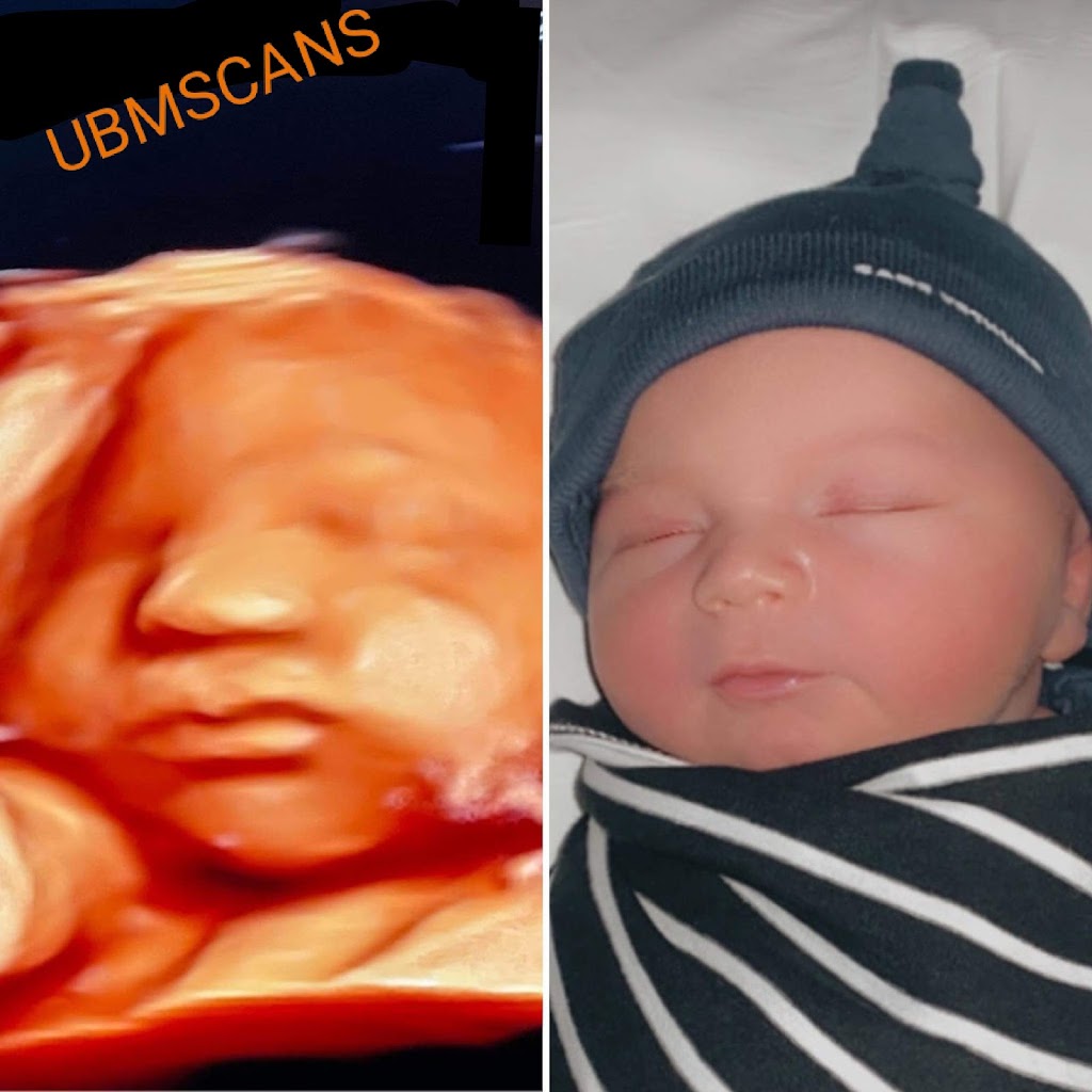 UBM 3D/4D Ultrasound Scans | 10 Anzac Rd, Menai NSW 2234, Australia | Phone: 0423 550 063