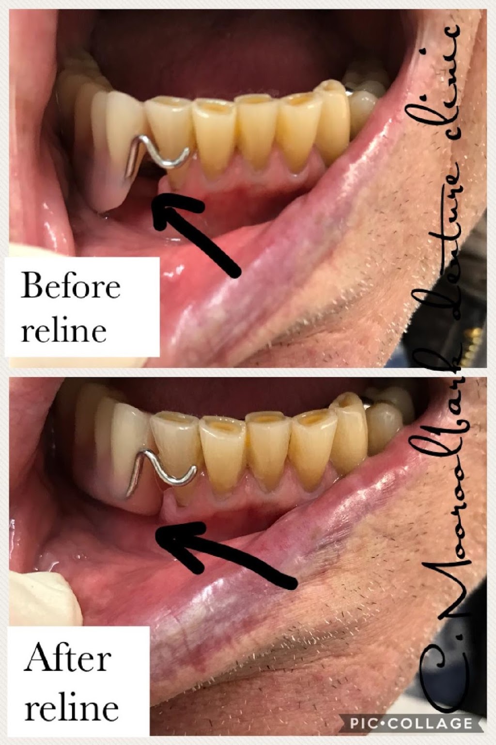 Mooroolbark denture clinic . Making Smiles Come To Life | dentist | 13/91 Brice Ave, Mooroolbark VIC 3138, Australia | 0397267284 OR +61 3 9726 7284